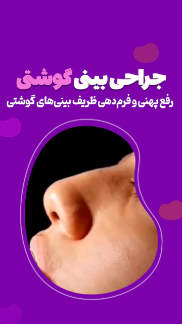 جراحی بینی گوشتی