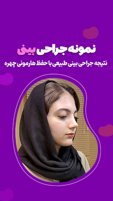نمونه کار جراحی بینی