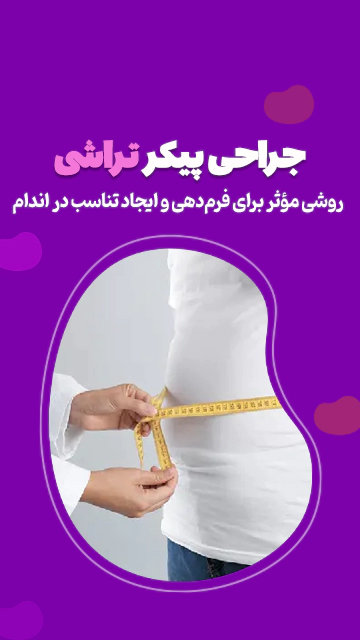 عمل پیکرتراشی در تهران